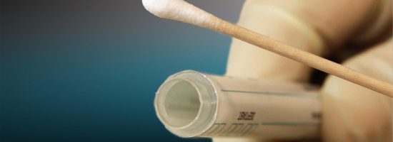 Kit ADN test Toma de muestra para prueba de ADN
VPH
paternidad
ADNLIFE
Genolife
