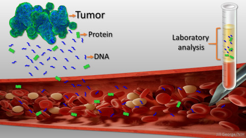 liquid biopsy genolife