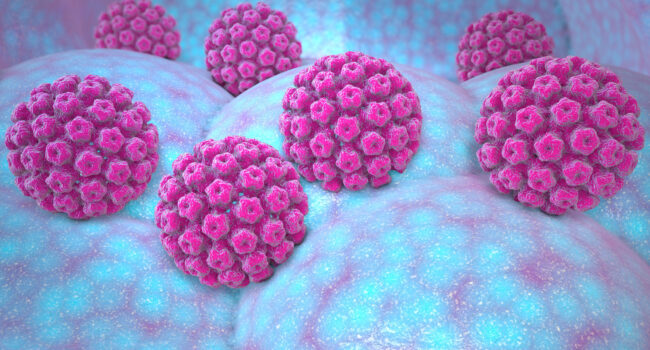 Human papillomavirus infection. Virus. HPV is the most common se vph
VIRUS
INFECCION
SEXUAL
TRANSMISION
HOMBRE
MUJER