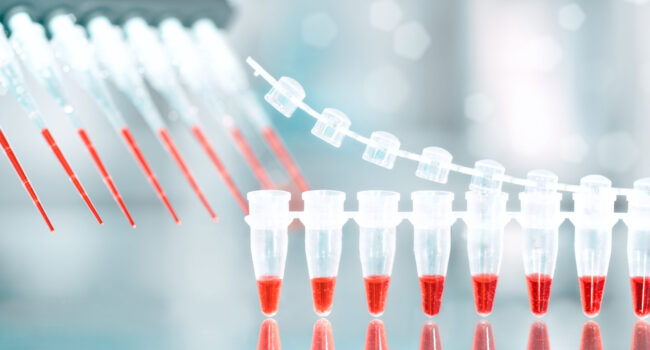DNA amplification test and reaction mixture in multichannel automatic pipette. PCR, polymerase chain reacton reagents and tools. DNA amplification test and reaction mixture in multichannel automatic pipette. PCR, polymerase chain reacton reagents and tools. Molecular biology background. Coronavirus Covid 19 testing.